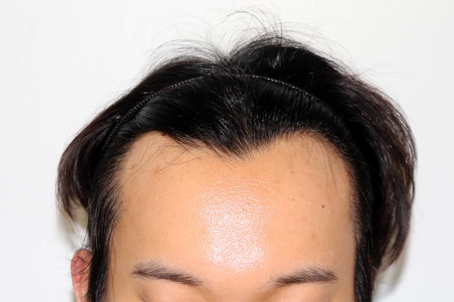 Before