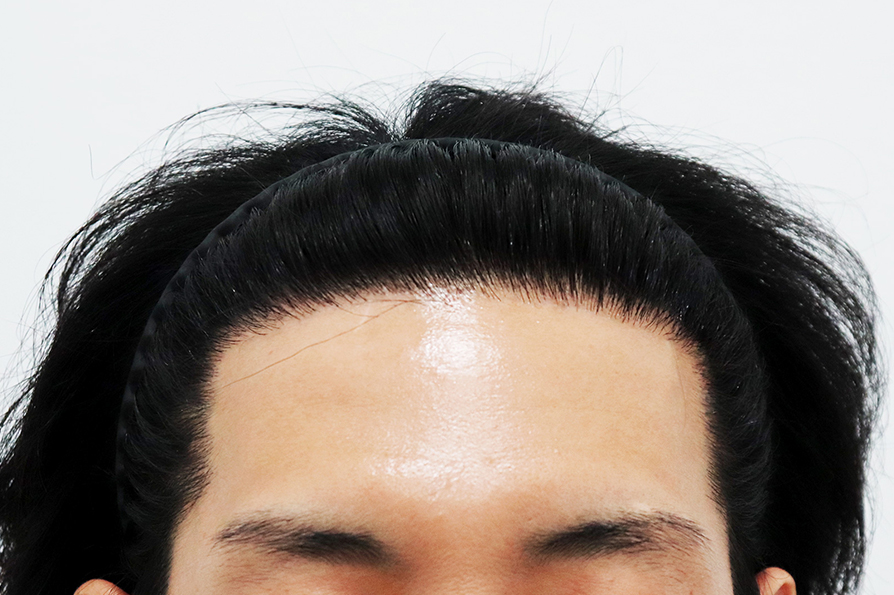 After