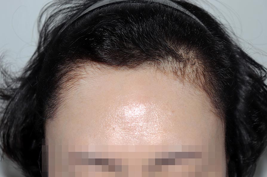 Before