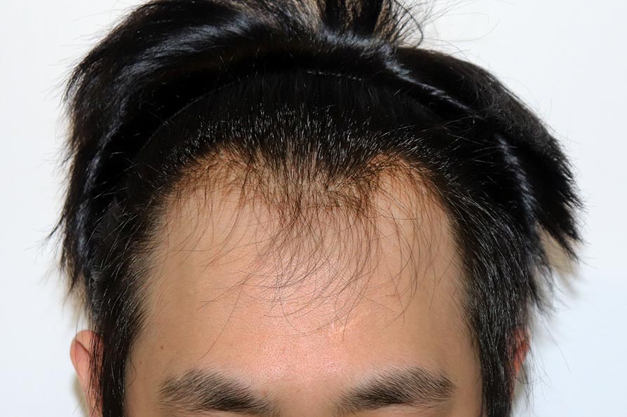 Before