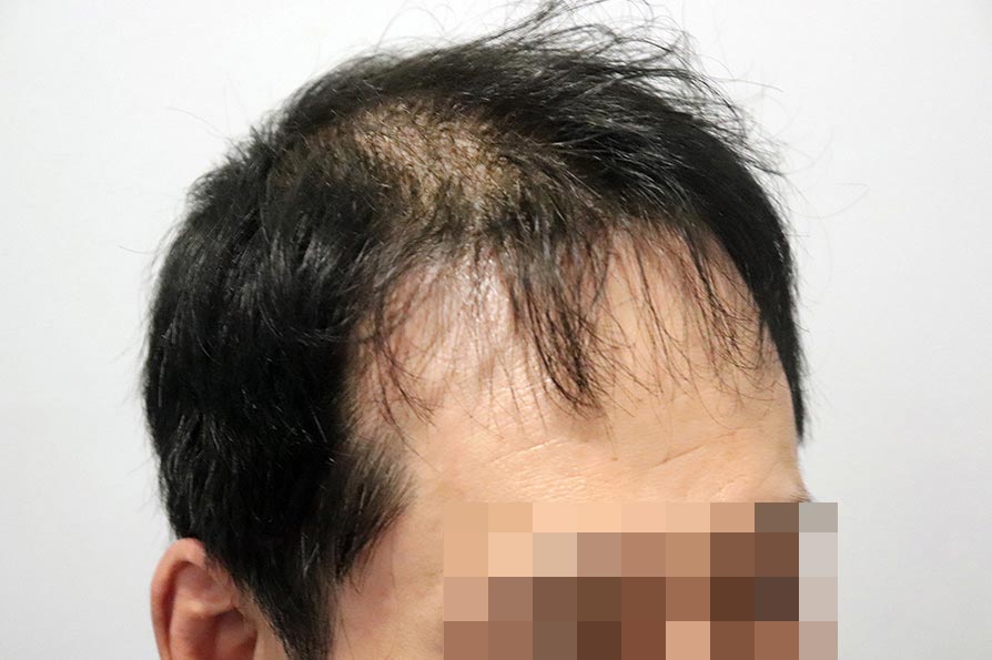 Before