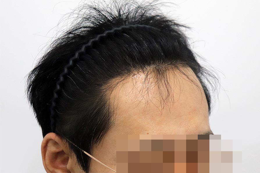 After